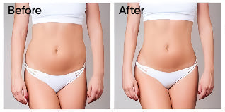 Red & Infrared Light SCULPT Belt